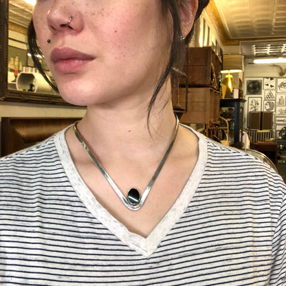 Close-up portrait of a woman with acne wearing a striped shirt and an ornate silver and black stone pendant necklace